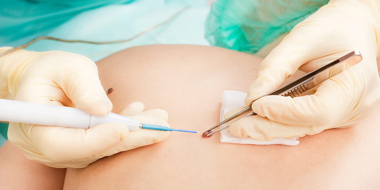 Dermatología Las Palmas